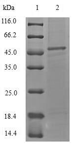 (Tris-Glycine gel) Discontinuous SDS-PAGE (reduced) with 5% enrichment gel and 15% separation gel.