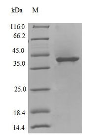 (Tris-Glycine gel) Discontinuous SDS-PAGE (reduced) with 5% enrichment gel and 15% separation gel.