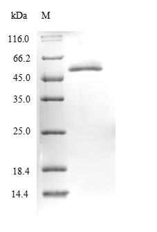 (Tris-Glycine gel) Discontinuous SDS-PAGE (reduced) with 5% enrichment gel and 15% separation gel.