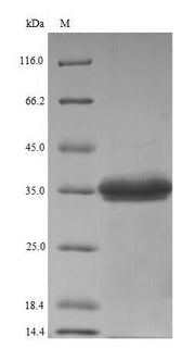 (Tris-Glycine gel) Discontinuous SDS-PAGE (reduced) with 5% enrichment gel and 15% separation gel.