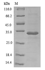 (Tris-Glycine gel) Discontinuous SDS-PAGE (reduced) with 5% enrichment gel and 15% separation gel.