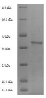 (Tris-Glycine gel) Discontinuous SDS-PAGE (reduced) with 5% enrichment gel and 15% separation gel.
