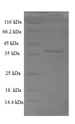 (Tris-Glycine gel) Discontinuous SDS-PAGE (reduced) with 5% enrichment gel and 15% separation gel.
