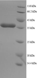 (Tris-Glycine gel) Discontinuous SDS-PAGE (reduced) with 5% enrichment gel and 15% separation gel.