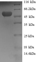(Tris-Glycine gel) Discontinuous SDS-PAGE (reduced) with 5% enrichment gel and 15% separation gel.