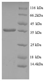(Tris-Glycine gel) Discontinuous SDS-PAGE (reduced) with 5% enrichment gel and 15% separation gel.