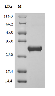 (Tris-Glycine gel) Discontinuous SDS-PAGE (reduced) with 5% enrichment gel and 15% separation gel.