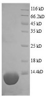 (Tris-Glycine gel) Discontinuous SDS-PAGE (reduced) with 5% enrichment gel and 15% separation gel.