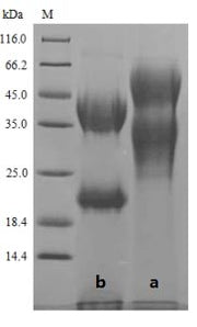 (Tris-Glycine gel) Discontinuous SDS-PAGE (reduced) with 5% enrichment gel and 15% separation gel.