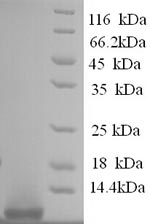 (Tris-Glycine gel) Discontinuous SDS-PAGE (reduced) with 5% enrichment gel and 15% separation gel.
