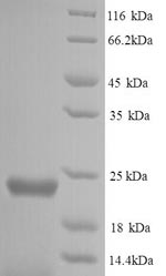(Tris-Glycine gel) Discontinuous SDS-PAGE (reduced) with 5% enrichment gel and 15% separation gel.