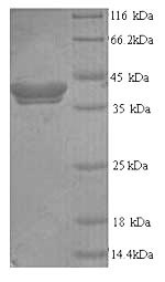 (Tris-Glycine gel) Discontinuous SDS-PAGE (reduced) with 5% enrichment gel and 15% separation gel.