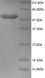 (Tris-Glycine gel) Discontinuous SDS-PAGE (reduced) with 5% enrichment gel and 15% separation gel.