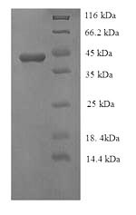 (Tris-Glycine gel) Discontinuous SDS-PAGE (reduced) with 5% enrichment gel and 15% separation gel.