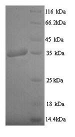 (Tris-Glycine gel) Discontinuous SDS-PAGE (reduced) with 5% enrichment gel and 15% separation gel.