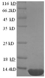 (Tris-Glycine gel) Discontinuous SDS-PAGE (reduced) with 5% enrichment gel and 15% separation gel.