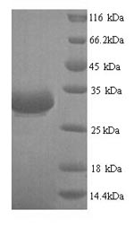 (Tris-Glycine gel) Discontinuous SDS-PAGE (reduced) with 5% enrichment gel and 15% separation gel.