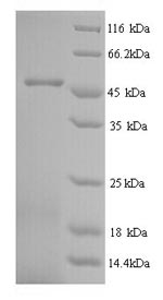 (Tris-Glycine gel) Discontinuous SDS-PAGE (reduced) with 5% enrichment gel and 15% separation gel.