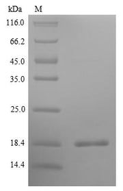 (Tris-Glycine gel) Discontinuous SDS-PAGE (reduced) with 5% enrichment gel and 15% separation gel.