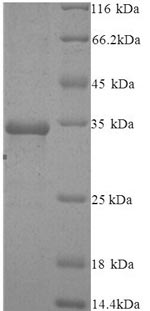 (Tris-Glycine gel) Discontinuous SDS-PAGE (reduced) with 5% enrichment gel and 15% separation gel.