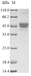 (Tris-Glycine gel) Discontinuous SDS-PAGE (reduced) with 5% enrichment gel and 15% separation gel.