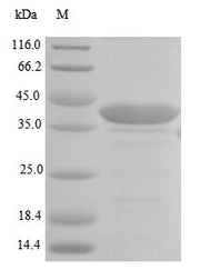 (Tris-Glycine gel) Discontinuous SDS-PAGE (reduced) with 5% enrichment gel and 15% separation gel.