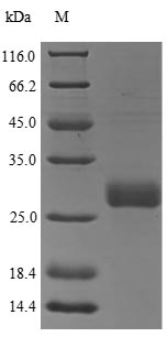 (Tris-Glycine gel) Discontinuous SDS-PAGE (reduced) with 5% enrichment gel and 15% separation gel.