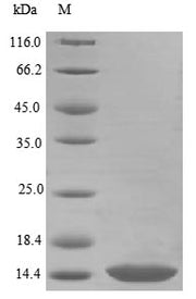 (Tris-Glycine gel) Discontinuous SDS-PAGE (reduced) with 5% enrichment gel and 15% separation gel.