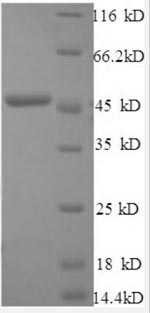 (Tris-Glycine gel) Discontinuous SDS-PAGE (reduced) with 5% enrichment gel and 15% separation gel.