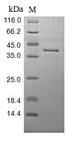 (Tris-Glycine gel) Discontinuous SDS-PAGE (reduced) with 5% enrichment gel and 15% separation gel.
