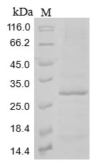 (Tris-Glycine gel) Discontinuous SDS-PAGE (reduced) with 5% enrichment gel and 15% separation gel.