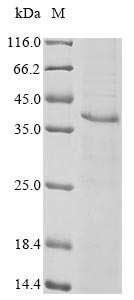 (Tris-Glycine gel) Discontinuous SDS-PAGE (reduced) with 5% enrichment gel and 15% separation gel.