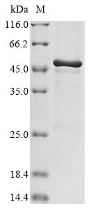 (Tris-Glycine gel) Discontinuous SDS-PAGE (reduced) with 5% enrichment gel and 15% separation gel.