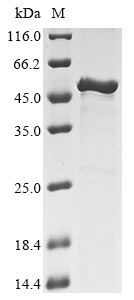 (Tris-Glycine gel) Discontinuous SDS-PAGE (reduced) with 5% enrichment gel and 15% separation gel.