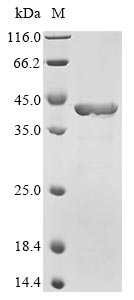 (Tris-Glycine gel) Discontinuous SDS-PAGE (reduced) with 5% enrichment gel and 15% separation gel.