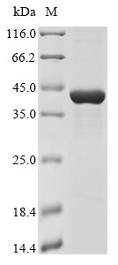(Tris-Glycine gel) Discontinuous SDS-PAGE (reduced) with 5% enrichment gel and 15% separation gel.