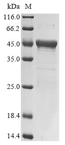 (Tris-Glycine gel) Discontinuous SDS-PAGE (reduced) with 5% enrichment gel and 15% separation gel.