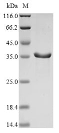 (Tris-Glycine gel) Discontinuous SDS-PAGE (reduced) with 5% enrichment gel and 15% separation gel.