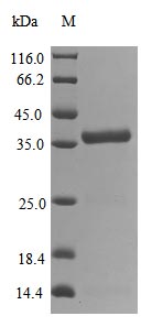(Tris-Glycine gel) Discontinuous SDS-PAGE (reduced) with 5% enrichment gel and 15% separation gel.