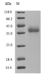 (Tris-Glycine gel) Discontinuous SDS-PAGE (reduced) with 5% enrichment gel and 15% separation gel.