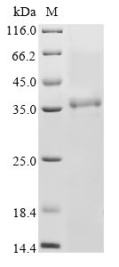 (Tris-Glycine gel) Discontinuous SDS-PAGE (reduced) with 5% enrichment gel and 15% separation gel.