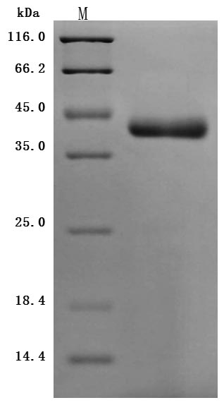(Tris-Glycine gel) Discontinuous SDS-PAGE (reduced) with 5% enrichment gel and 15% separation gel.