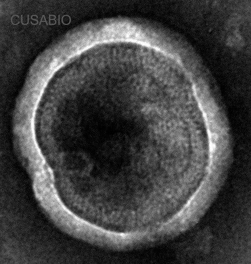 The presence of VLP-like structures was confirmed by TEM