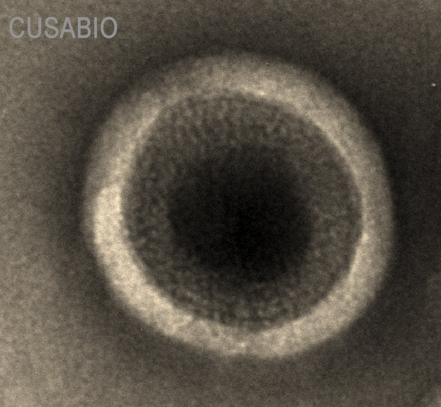 The presence of VLP-like structures was confirmed by TEM