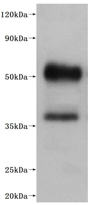RPC28111 is detected by Mouse anti-6*His monoclonal antibody.
