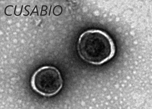 The presence of VLP-like structures was confirmed by TEM