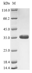 (Tris-Glycine gel) Discontinuous SDS-PAGE (reduced) with 5% enrichment gel and 15% separation gel.
