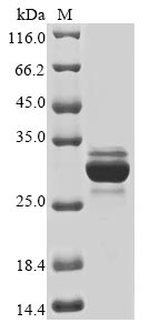 (Tris-Glycine gel) Discontinuous SDS-PAGE (reduced) with 5% enrichment gel and 15% separation gel.