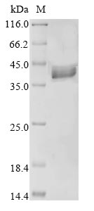 (Tris-Glycine gel) Discontinuous SDS-PAGE (reduced) with 5% enrichment gel and 15% separation gel.