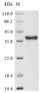 (Tris-Glycine gel) Discontinuous SDS-PAGE (reduced) with 5% enrichment gel and 15% separation gel.